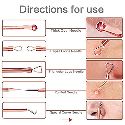 Cueen™ 4Pcs Blackhead Pimple Golden Remover Tools